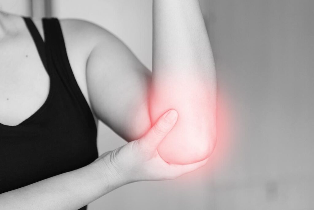 Radiuskopfractuur herstel met deskundige zorg en geavanceerde behandelingstechnieken van het Elleboogklachten Expertise Centr
